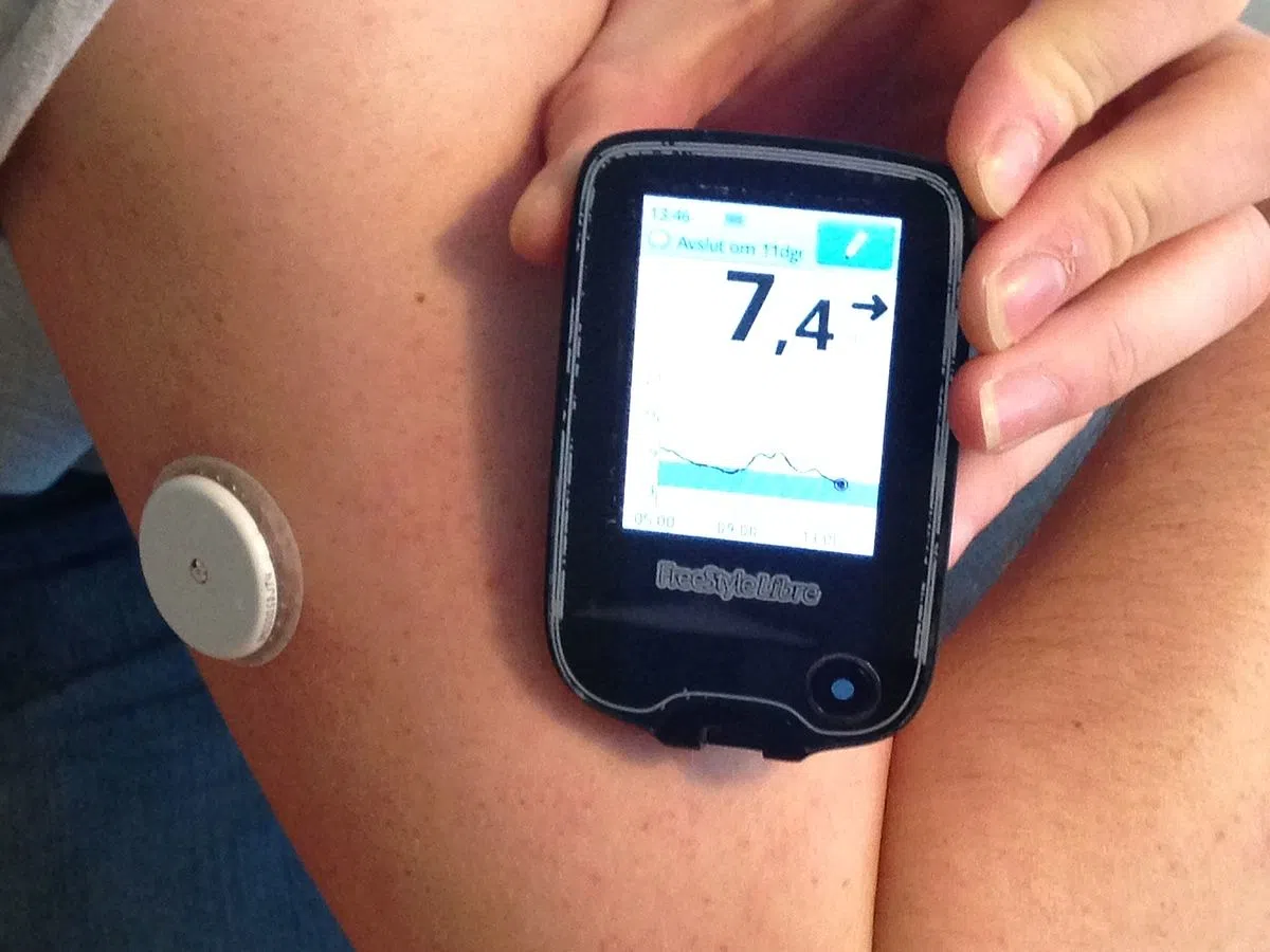 Continuous glucose monitoring sensor on arm with FreeStyle Libre reader showing blood glucose level and trends
