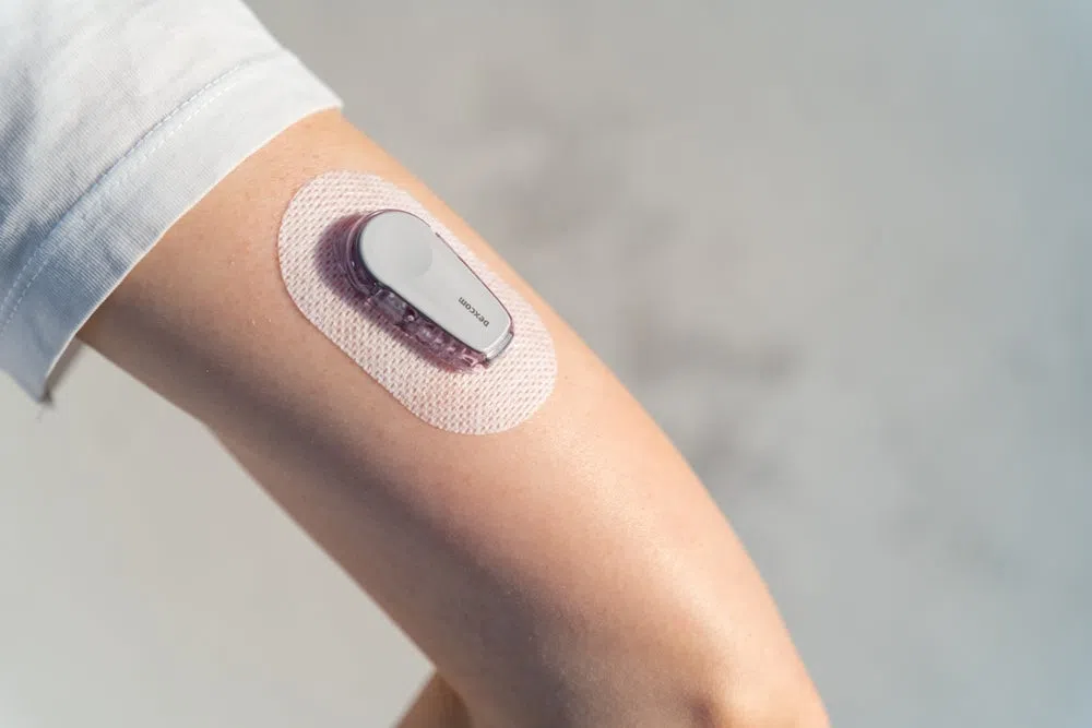 Continuous glucose monitor attached to a person's arm for real-time blood sugar monitoring